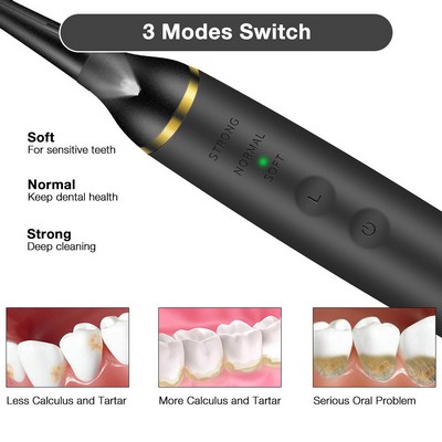 Electric Plaque Remover For Teeth